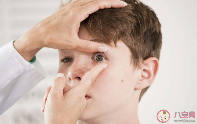 暑假期間可以不戴角膜塑形鏡嗎 戴了OK鏡近視就不會(huì)增長了嗎