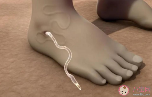 龍線蟲是什么蟲子 龍線蟲在人體有什么危害