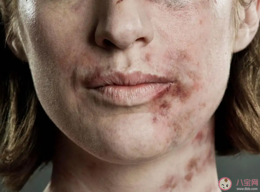 遭遇家暴如何申請人身安全保護令 人身安全保護令的時效是多久