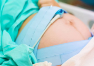 剖腹產可以讓醫生順便把肚子上的脂肪割掉一些嗎 剖腹產術后要注意什么