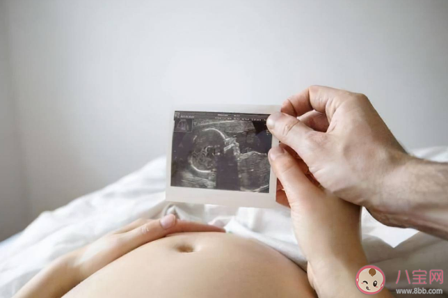 孕晚期喝椰青水可以使羊水變清澈嗎 如何保持羊水清澈 孕晚期喝椰青水可以使羊水變清澈嗎 如何保持羊水清澈