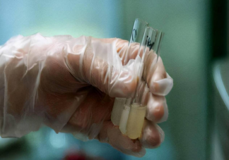 工作人員稱志愿者精子合格率僅約20%是真的嗎 一次完整的捐精需要多少次