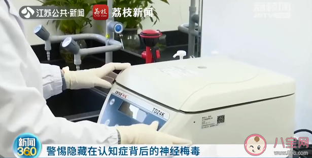 男子記性突然變差竟是感染梅毒20年是怎么回事 避孕套可以阻斷梅毒嗎