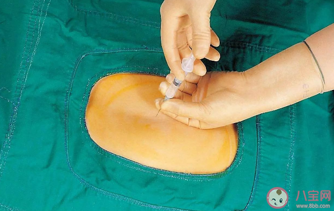 無(wú)痛分娩會(huì)落下腰痛嗎 哪些孕婦適合分娩鎮(zhèn)痛