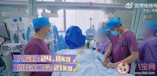 那個(gè)為愛減肥的廣東少女走了 神經(jīng)性厭食有何危害