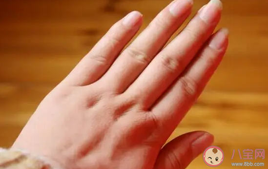 減肥期間去水腫的辦法有哪些 減肥為什么會水腫