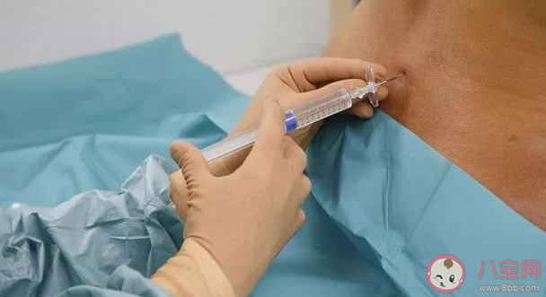 打無(wú)痛分娩針時(shí)不能動(dòng)嗎 打無(wú)痛分娩針有沒(méi)有副作用