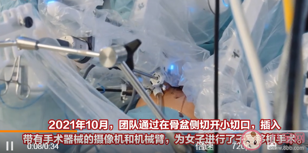 全球首例機械臂輔助移植子宮誕下嬰兒 子宮移植手術成功率高嗎