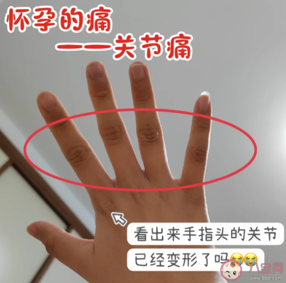 孕期出現關節痛是什么原因 孕期關節痛怎么辦 孕期出現關節痛是什么原因 孕期關節痛怎么辦