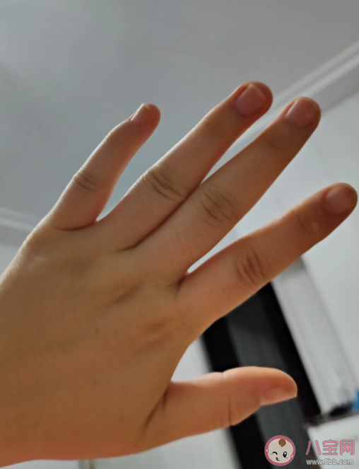 孕期出現關節痛是什么原因 孕期關節痛怎么辦 孕期出現關節痛是什么原因 孕期關節痛怎么辦