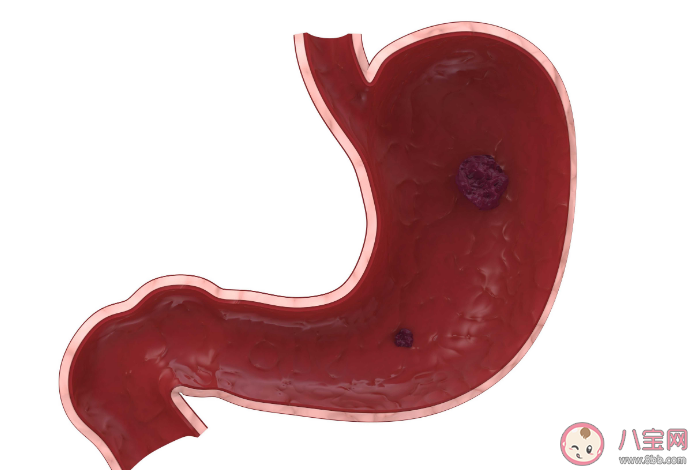 為什么做胃鏡還要查梅毒和艾滋病 胃腸鏡檢查的流程是怎樣的 為什么做胃鏡還要查梅毒和艾滋病 胃腸鏡檢查的流程是怎樣的