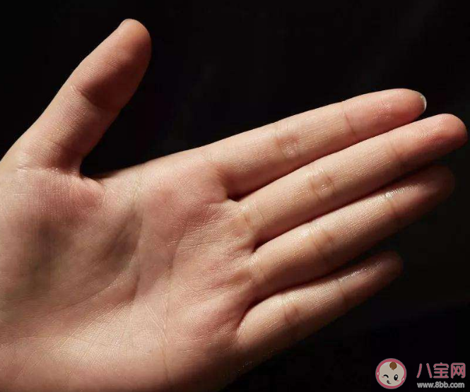 手汗癥為什么要去胸外科治療 手汗癥需要手術治療嗎