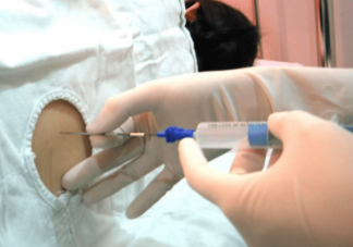 全麻手術人是不會自主呼吸的 全麻手術有后遺癥嗎