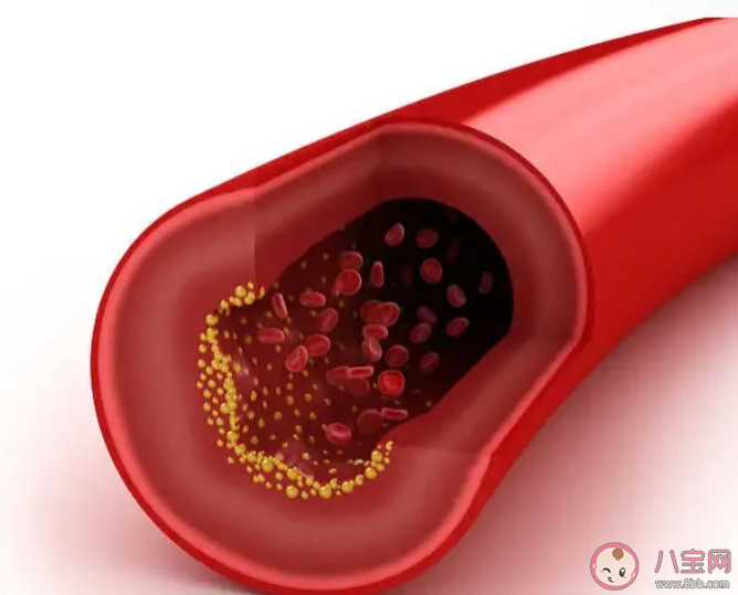 哪些人要監測夜間血壓 如何發現夜間高血壓