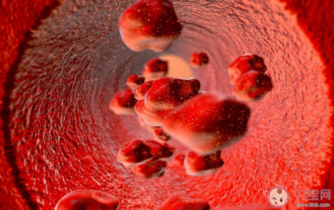 如何預防靜脈血栓形成 哪些人是血栓形成的高危人群