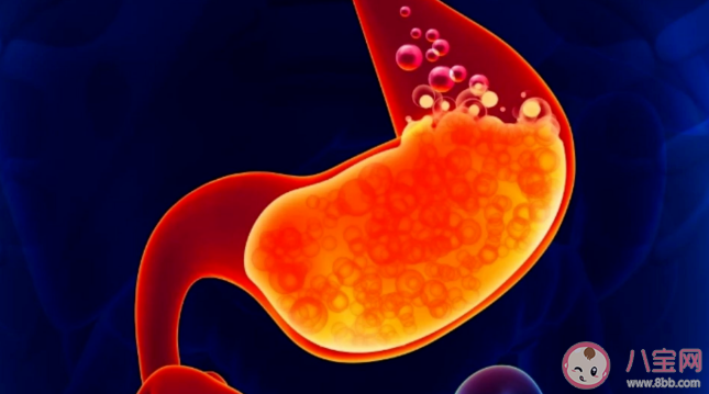 自我判斷反酸燒心看四點 胃食管反流如何治療 自我判斷反酸燒心看四點 胃食管反流如何治療