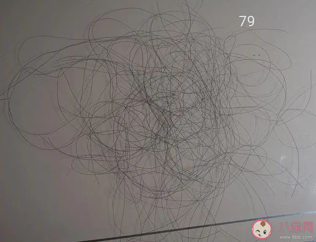 哪個季節是脫發高峰期 脫發了該做哪些檢查 哪個季節是脫發高峰期 脫發了該做哪些檢查