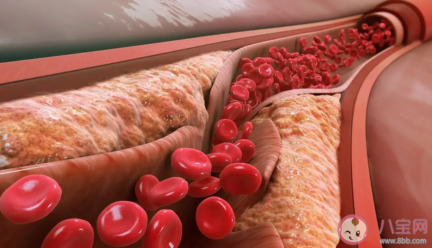 吃素不吃肉能降血脂嗎 降血脂應該吃什么 吃素不吃肉能降血脂嗎 降血脂應該吃什么