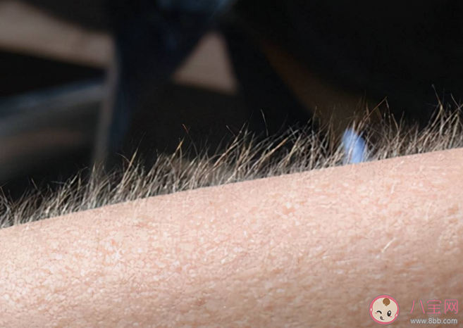 體毛會越刮越多越刮越粗嗎 體毛多有哪些脫毛方法 體毛會越刮越多越刮越粗嗎 體毛多有哪些脫毛方法