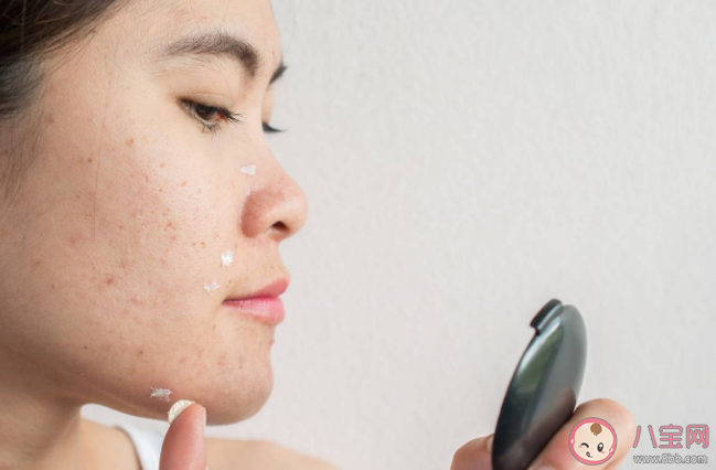 為什么月經前最容易長痘 如何改善姨媽痘 為什么月經前最容易長痘 如何改善姨媽痘