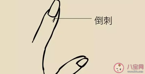 倒刺為什么不能隨便拔 手指上為什么會長倒刺