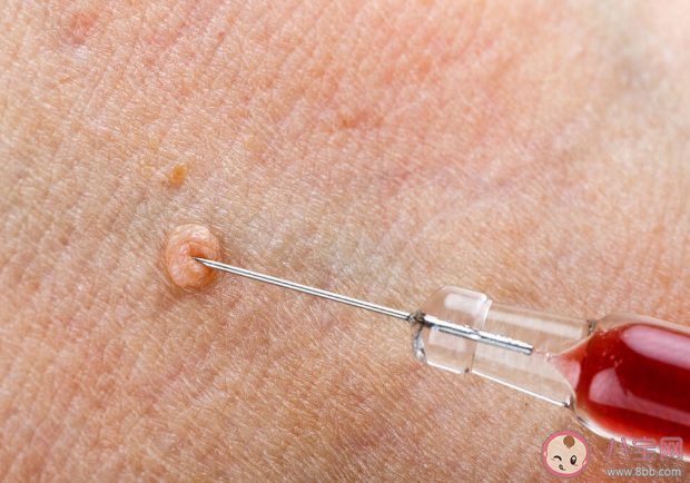 男性比女性更易感染HPV 男性感染HPV有多可怕 男性比女性更易感染HPV 男性感染HPV有多可怕