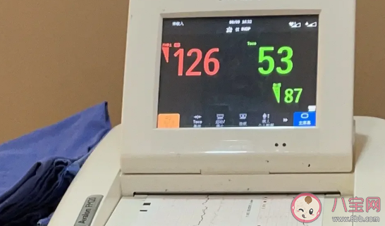 頻繁胎心監(jiān)測有必要嗎 醫(yī)院做胎心監(jiān)護的小技巧 頻繁胎心監(jiān)測有必要嗎 醫(yī)院做胎心監(jiān)護的小技巧