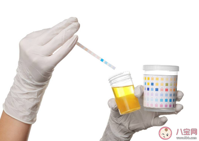 體檢時為何要留晨尿 尿檢為什么要中段尿 體檢時為何要留晨尿 尿檢為什么要中段尿