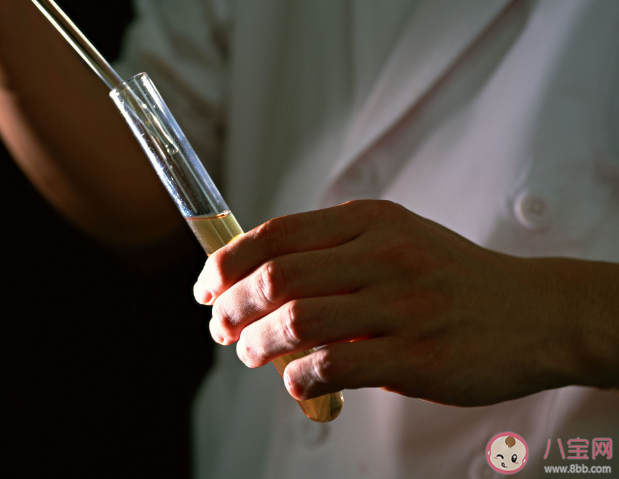 體檢時為何要留晨尿 尿檢為什么要中段尿 體檢時為何要留晨尿 尿檢為什么要中段尿