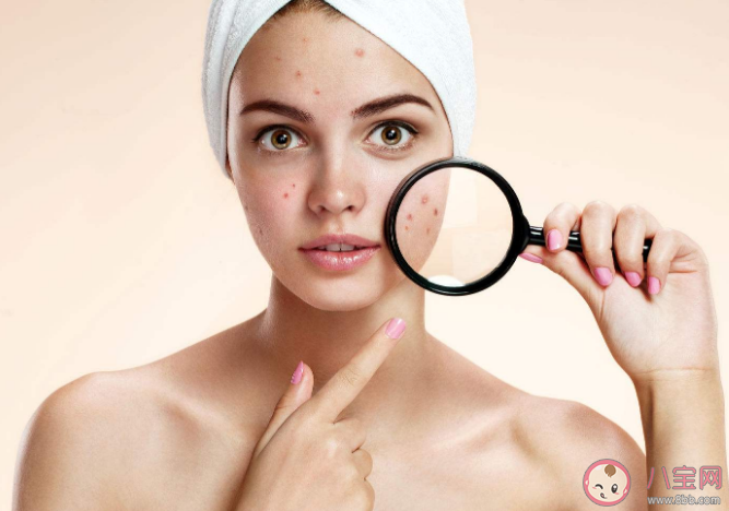 痘痘為什么會氧化變黑 這20個長痘原因你中了嗎