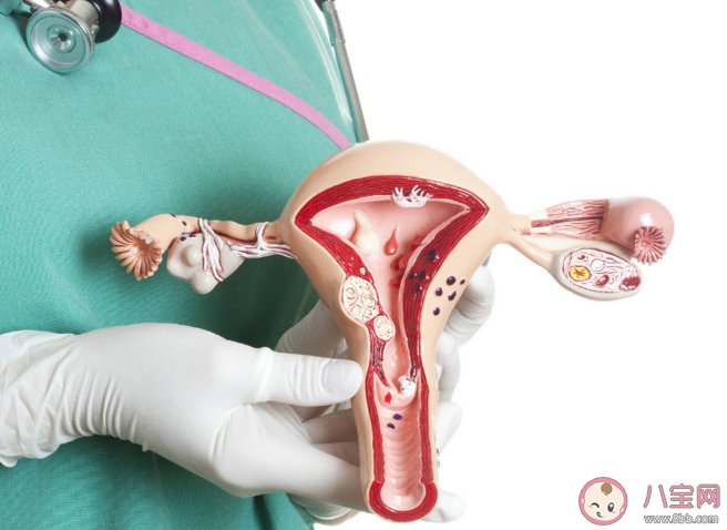 什么樣的子宮肌瘤會惡變 手術能否徹底清除子宮肌瘤 什么樣的子宮肌瘤會惡變 手術能否徹底清除子宮肌瘤