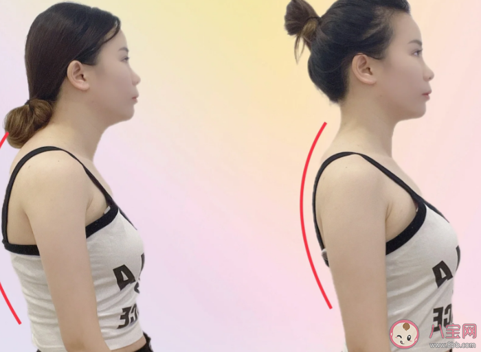 烏龜頸有什么危害 出現烏龜頸怎么辦 烏龜頸有什么危害 出現烏龜頸怎么辦