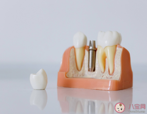 種植牙會(huì)干擾影像檢查嗎 種植牙松動(dòng)了怎么辦