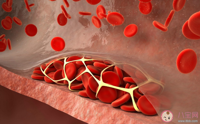 血管粗細會影響血栓形成嗎 血栓容易發生在哪些部位 血管粗細會影響血栓形成嗎 血栓容易發生在哪些部位