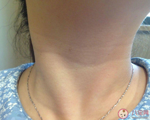 按摩淋巴結能排毒嗎 什么情況下淋巴結是異常的 按摩淋巴結能排毒嗎 什么情況下淋巴結是異常的