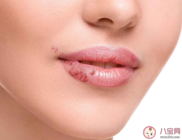 為什么嘴唇特別容易干 嘴唇干涂唇膏沒用是怎么回事