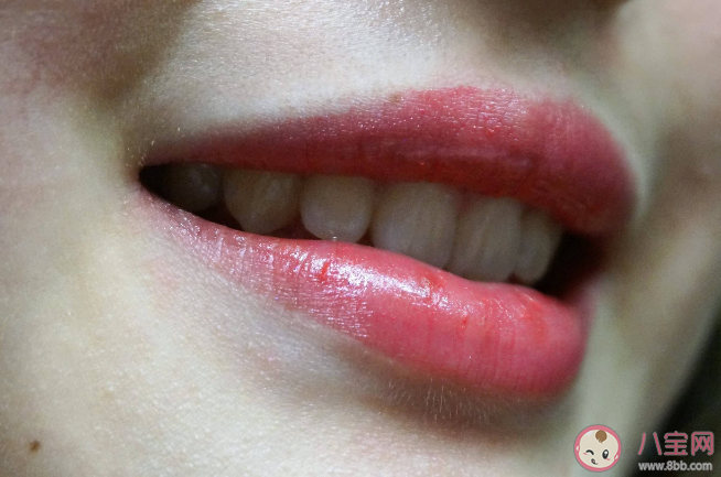 為什么嘴唇特別容易干 嘴唇干涂唇膏沒用是怎么回事