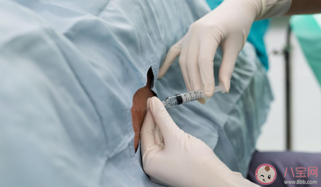 無痛分娩比剖宮產的副作用大嗎 醫生為什么推薦分娩陣痛 無痛分娩比剖宮產的副作用大嗎 醫生為什么推薦分娩陣痛