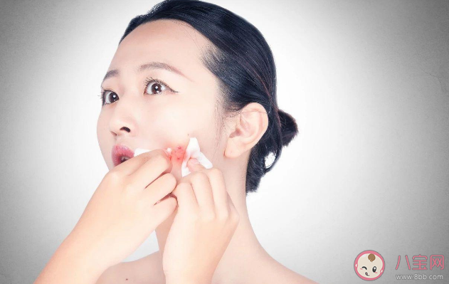 反復(fù)長(zhǎng)痘其實(shí)是濕熱體質(zhì)引起的 濕熱體質(zhì)如何調(diào)理