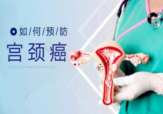預防宮頸癌的有效辦法有哪些 宮頸癌的早期癥狀是什么