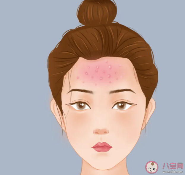 不同部位長(zhǎng)痘各有病根嗎 長(zhǎng)痘與身體器官的聯(lián)系是怎樣的 不同部位長(zhǎng)痘各有病根嗎 長(zhǎng)痘與身體器官的聯(lián)系是怎樣的
