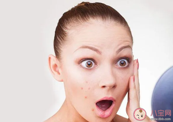 不同部位長(zhǎng)痘各有病根嗎 長(zhǎng)痘與身體器官的聯(lián)系是怎樣的 不同部位長(zhǎng)痘各有病根嗎 長(zhǎng)痘與身體器官的聯(lián)系是怎樣的