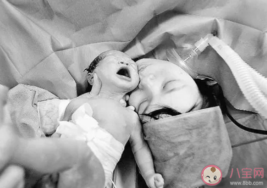 如何緩解女性的生育痛苦 女性生育過程有多難