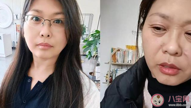 42歲女子20天斷崖式衰老是怎么回事 為什么會出現斷崖式衰老