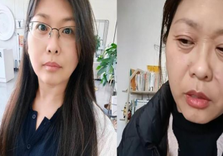 42歲女子20天斷崖式衰老是怎么回事 為什么會出現斷崖式衰老