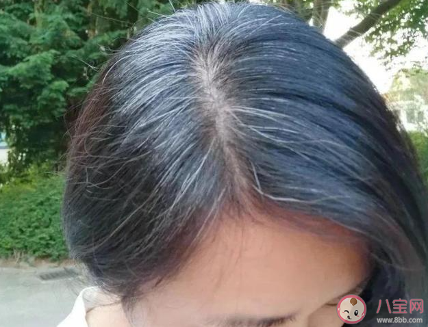 白頭發可能是身體給你的警報 為什么會有白頭發出現