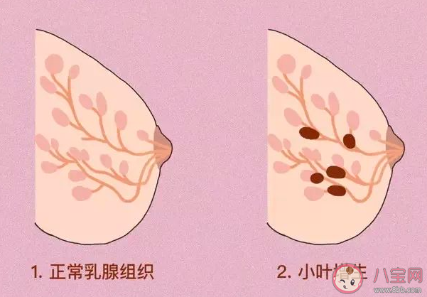 乳腺增生不能吃豆制品嗎 乳腺增生哪些東西不能吃