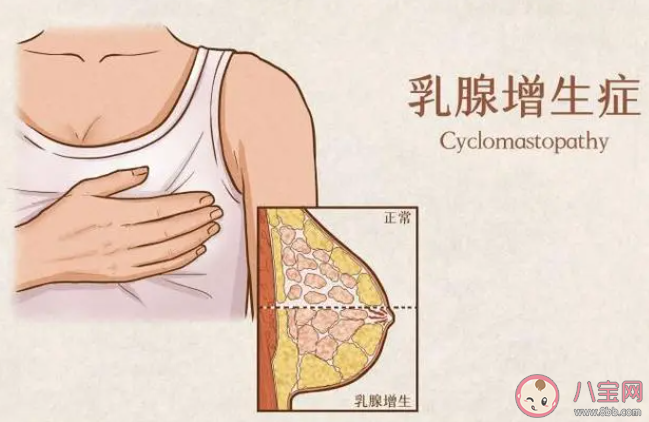 乳腺增生不能吃豆制品嗎 乳腺增生哪些東西不能吃