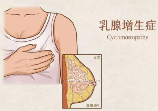 乳腺增生不能吃豆制品嗎 乳腺增生哪些東西不能吃