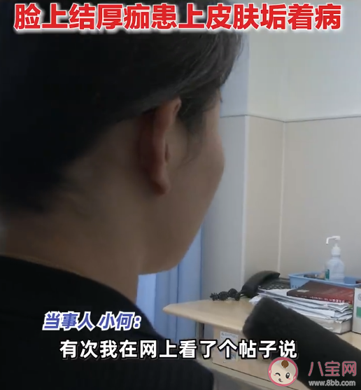 女子為護膚1個月不洗臉致滿臉結(jié)痂 長時間不洗臉會怎樣